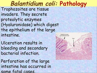 Trophozoites are tissue invaders. They secrete proteolytic enzymes ( Hyaluronidase)  which digest the epithelium of the large intestine. Ulceration results in bleeding and secondary bacterial infection.  Perforation of the large intestine has occurred in some fatal cases.  Balantidium coli:  Pathology 