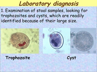 1. Examination of stool samples, looking for trophozoites and cysts, which are readily identified because of their large size. Cyst Trophozoite Laboratory diagnosis 