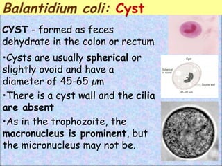 Cysts are usually  spherical  or slightly ovoid and have a diameter of 45-65 µm There is a cyst wall and the  cilia are absent As in the trophozoite, the  macronucleus is prominent , but the micronucleus may not be. CYST  - formed as feces dehydrate in the colon or rectum   Balantidium coli:  Cyst 