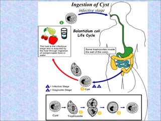 Balantidium coli   Life Cycle Ingestion of Cyst  :  infective stage 