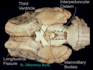 R- Olfactory Bulb
 
