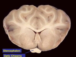 Optic Chiasma
Diencephalon:
 