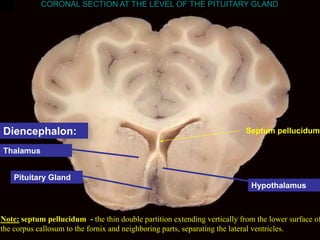 Pituitary Gland
Thalamus
Hypothalamus
CORONAL SECTION AT THE LEVEL OF THE PITUITARY GLAND
Note: septum pellucidum - the thin double partition extending vertically from the lower surface of
the corpus callosum to the fornix and neighboring parts, separating the lateral ventricles.
Septum pellucidum
Diencephalon:
 