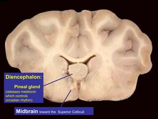 Diencephalon:
Pineal gland
(releases melatonin
which controls
circadian rhythm)
Midbrain toward the Superior Colliculi
 