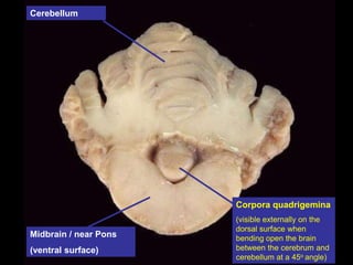 Cerebellum
Corpora quadrigemina
(visible externally on the
dorsal surface when
bending open the brain
between the cerebrum and
cerebellum at a 45o angle)
Midbrain / near Pons
(ventral surface)
 