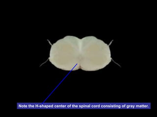 Note the H-shaped center of the spinal cord consisting of gray matter.
 