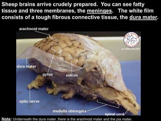 Sheep brains arrive crudely prepared. You can see fatty
tissue and three membranes, the meninges. The white film
consists of a tough fibrous connective tissue, the dura mater.
Note: Underneath the dura mater, there is the arachnoid mater and the pia mater.
spinal cord
 