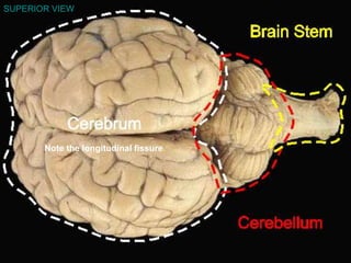 SUPERIOR VIEW
Note the longitudinal fissure.
 