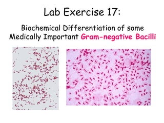 Lab Exercise 17: 
Biochemical Differentiation of some 
Medically Important Gram-negative Bacilli 
 
