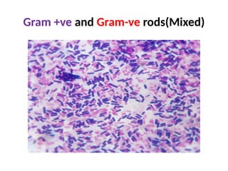 Mixed Rods Comprehensive Guide to Bacterial Staining Techniques and Gram Staining ...
