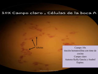 Campo 10x
tinción hematoxilina con tinte de
cocina
Campo claro
Autores Kelly García y Anabel
Espino.
Células
kelly Garcia y Anabel Espino
 