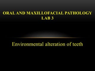 Environmental alteration of teeth
ORAL AND MAXILLOFACIAL PATHOLOGY
LAB 3
 