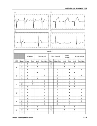 Analyzing the Heart with EKG

  e.                                                 f.




  g.                                                 h.




                                                 Table 3

                                                                          QRS
                    P Wave         PR Interval       QRS Interval                     T Wave Shape
                                                                         Shape

   ECG     Beat   Pres.   Abs.   Nml.   Abs./Abn.   Nml.   Abs./Abn.   Nml.    Abn.   Nml.   Abs./Abn.
            1      X              X                  X                  X              X

       a    2      X              X                  X                  X              X
            3      X                       X                  X                 X               X
            1      X              X                           X                 X      X

       b    2      X                       X                  X                 X               X
            3      X              X                           X                 X      X
            1              X               X                  X                 X      X

       c    2              X               X                  X                 X      X
            3      X                       X                  X                 X      X
            1      X                       X                  X                 X               X

       d    2      X                       X                  X                 X               X
            3      X                       X                  X                 X               X
            1      X                       X                  X                 X               X

       e    2      X                       X                  X                 X               X
            3      X                       X                  X                 X
            1      X              X                  X                  X              X

       f    2      X              X                  X                  X              X
            3


Human Physiology with Vernier                                                                       12 - 3
 