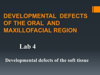 DEVELOPMENTAL DEFECTS
OF THE ORAL AND
MAXILLOFACIAL REGION
Developmental defects of the soft tissue
Lab 4
 