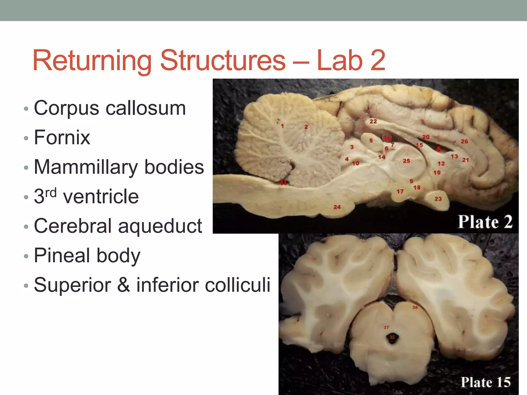 Returning Structures – Lab 2
• Corpus callosum
• Fornix
• Mammillary bodies
• 3rd ventricle
• Cerebral aqueduct
• Pineal body
• Superior & inferior colliculi
 