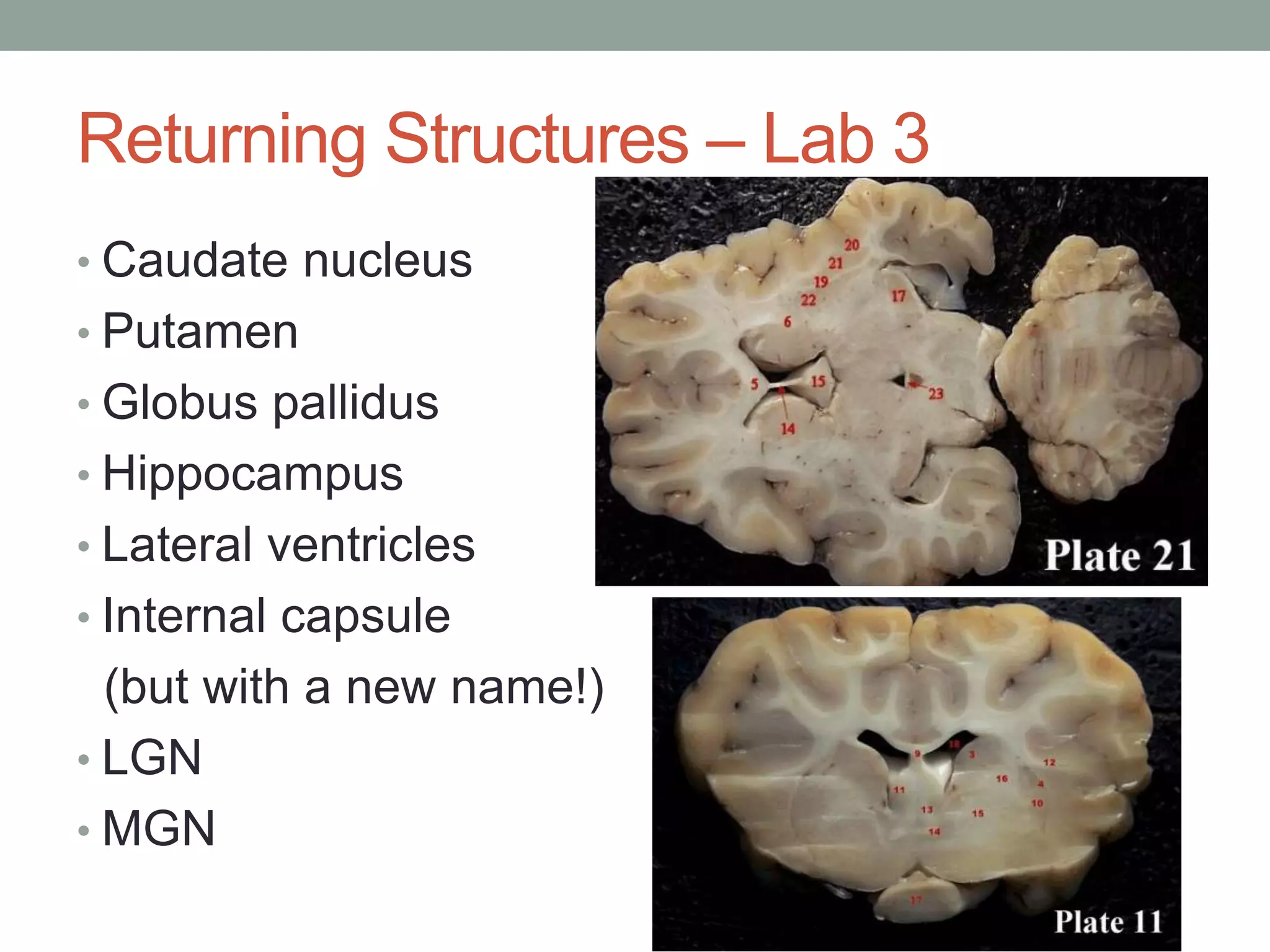Returning Structures – Lab 3
• Caudate nucleus
• Putamen
• Globus pallidus
• Hippocampus
• Lateral ventricles
• Internal capsule
(but with a new name!)
• LGN
• MGN
 