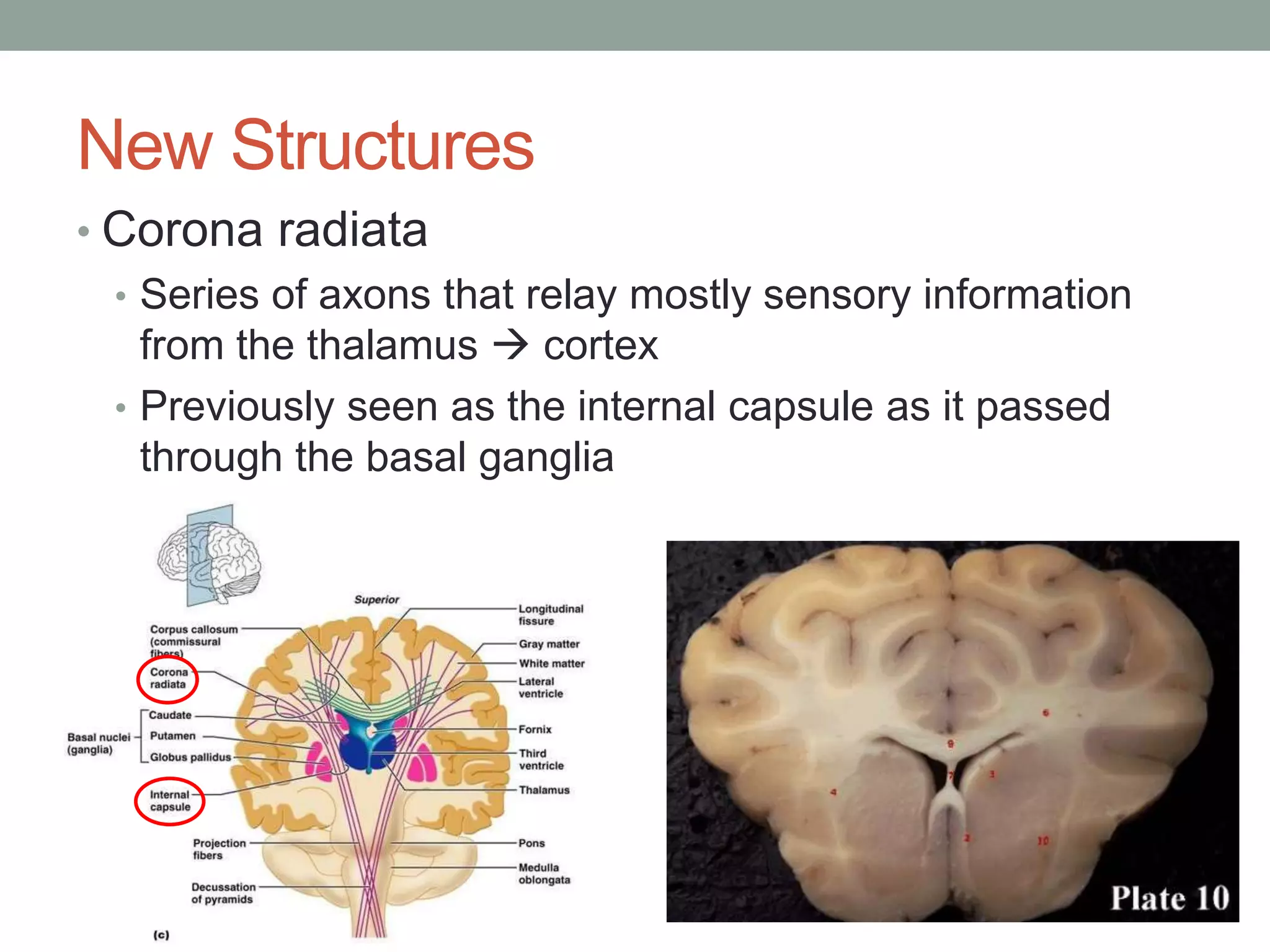 New Structures
• Corona radiata
• Series of axons that relay mostly sensory information
from the thalamus  cortex
• Previously seen as the internal capsule as it passed
through the basal ganglia
 