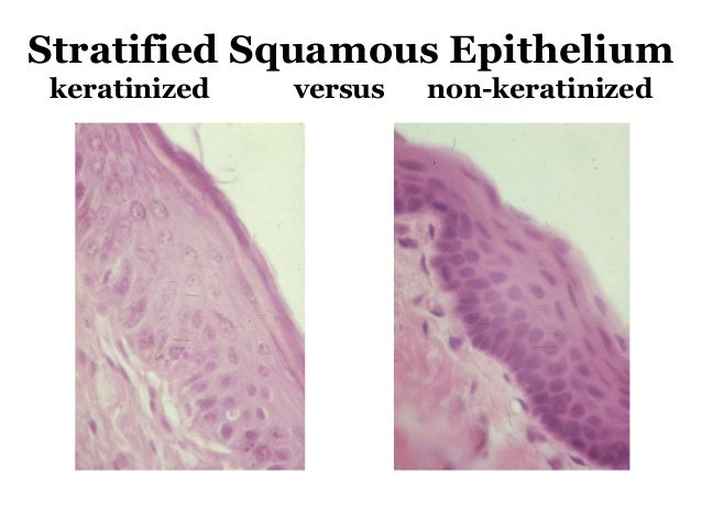 Keratinized Vs Non Keratinized Stratified Squamous Epithelium Stratified Squamous Epithelium Keratinized Vs Non Ker - vrogue.co