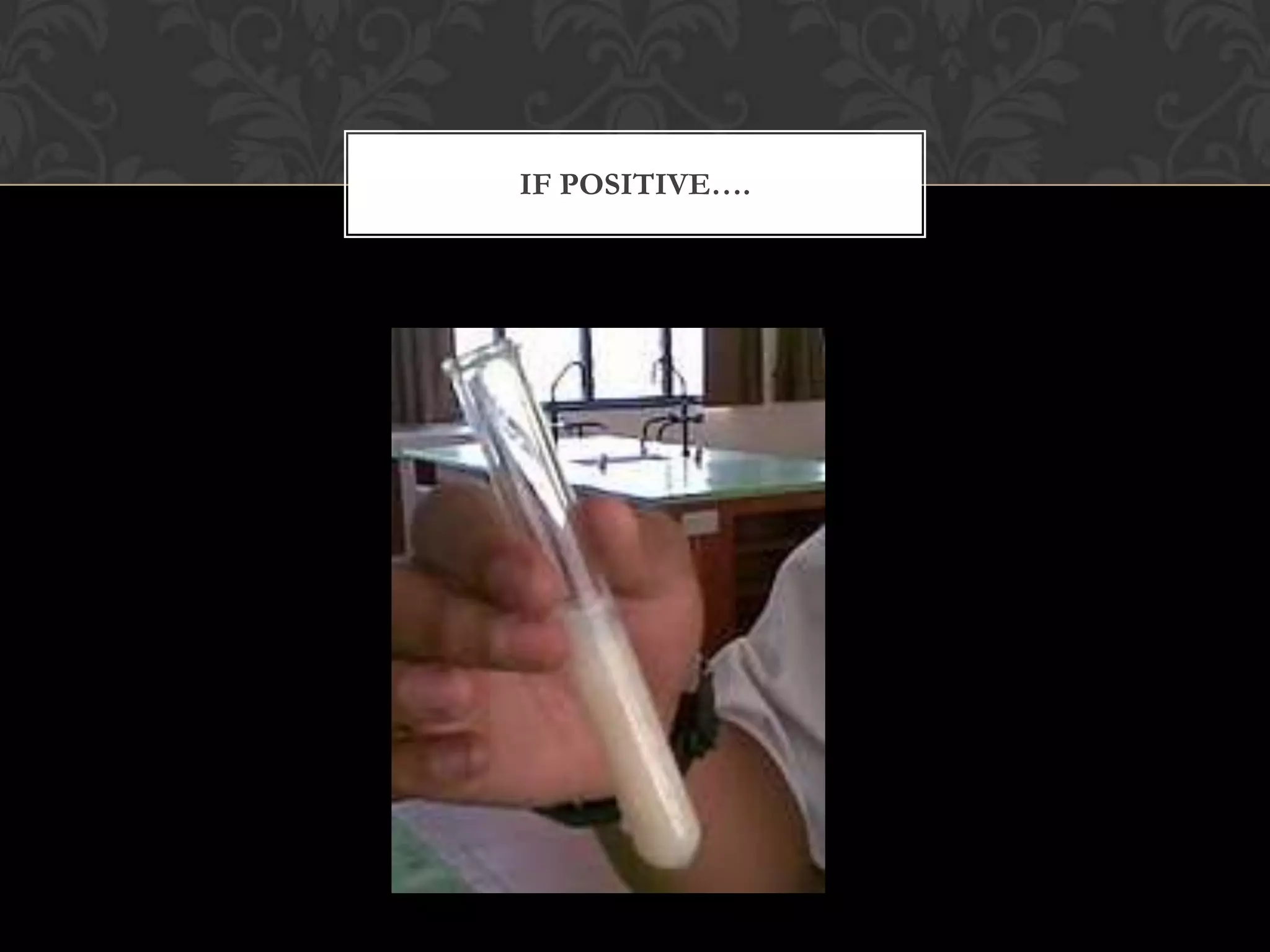 IF POSITIVE….
 