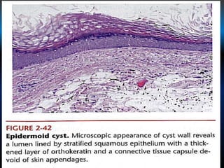 Shell Cyst Cell Lab 6 developmental cyst | PPTX