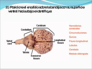 2.) Posicione el encefalo sobre la bandeja con su superficie ventral hacia abajo e identifique: Hemisferios cerebrales Circunvoluciones Surcos Fisura longitudinal Lobulos Cerebelo Medula oblongada 