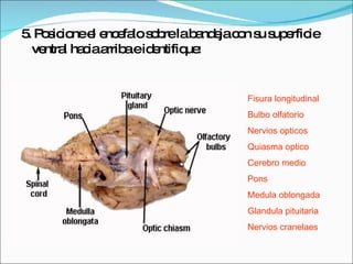 5. Posicione el encefalo sobre la bandeja con su superficie ventral hacia arriba e identifique: Fisura longitudinal Bulbo olfatorio Nervios opticos Quiasma optico Cerebro medio Pons Medula oblongada Glandula pituitaria Nervios cranelaes 