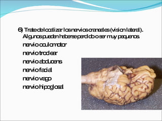 6)  Trate de localizar los nervios craneales (vision lateral). Algunos pueden haberse perdido o ser muy pequenos. nervio oculomotor nervio troclear nervio abducens nervio facial nervio vago nervio hipoglosal 