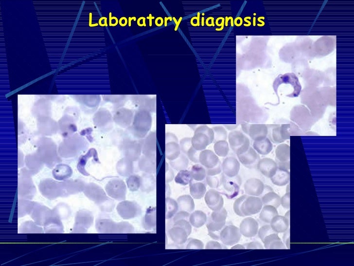 Lab 7 trypanosomiasis