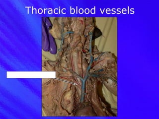 Thoracic blood vessels R subclavian artery 