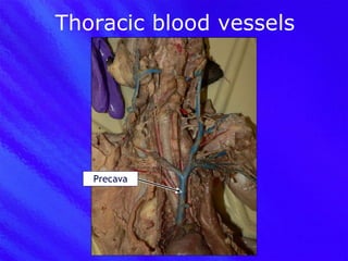 Thoracic blood vessels Precava 