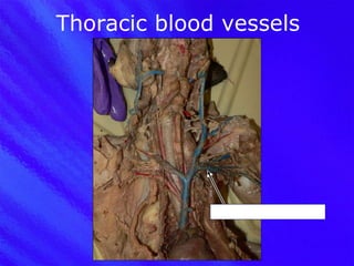 Thoracic blood vessels Left subclavian vein 