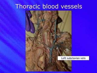 Thoracic blood vessels Left subclavian vein 
