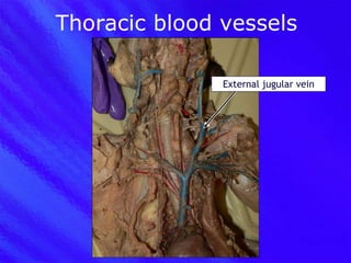 Thoracic blood vessels External jugular vein 