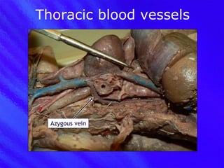 Thoracic blood vessels Azygous vein 