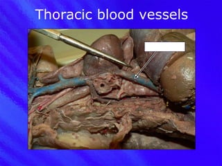 Thoracic blood vessels Postcava 