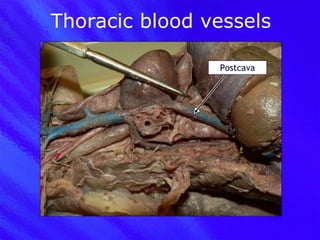Thoracic blood vessels Postcava 