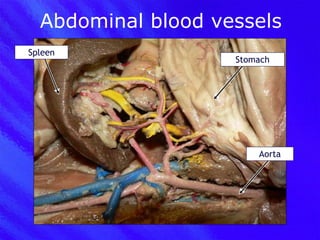 Abdominal blood vessels Stomach Spleen Aorta 