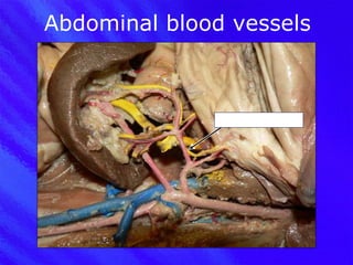 Abdominal blood vessels Spleenic artery 