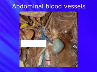 Abdominal blood vessels Superior mesenteric artery 