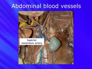 Abdominal blood vessels Superior mesenteric artery 