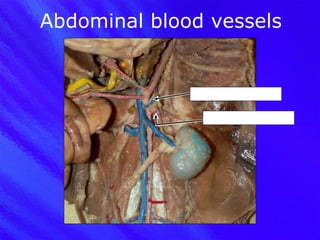 Abdominal blood vessels Adrenolumbar vein Adrenolumbar artery 