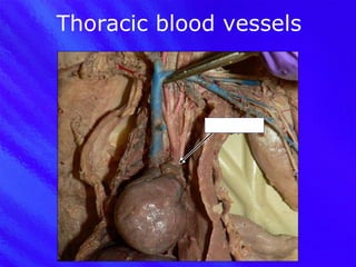 Thoracic blood vessels Aortic arch 