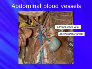 Abdominal blood vessels Adrenolumbar vein Adrenolumbar artery 