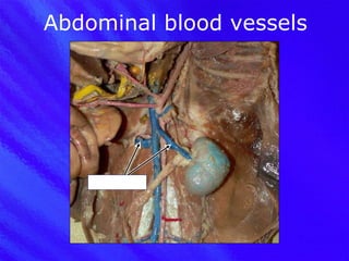 Abdominal blood vessels Renal vein 