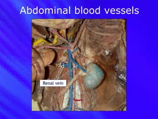 Abdominal blood vessels Renal vein 