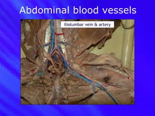 Abdominal blood vessels Iliolumbar vein & artery 