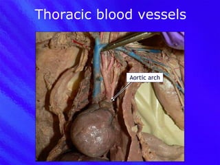 Thoracic blood vessels Aortic arch 