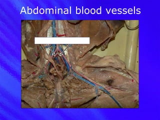 Abdominal blood vessels Internal iliac arteries 