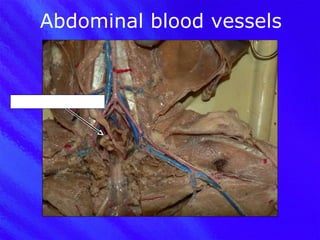 Abdominal blood vessels Internal iliac vein 
