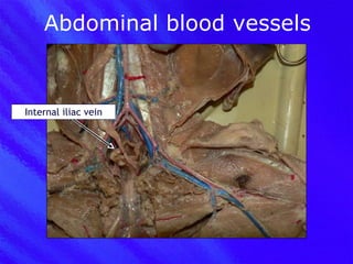 Abdominal blood vessels Internal iliac vein 